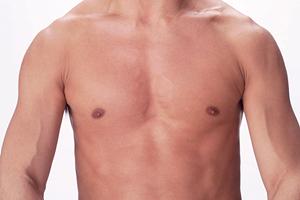 天神で注目のピコレーザー治療！シミ・ホクロ除去の最新情報と施術のメリット解説